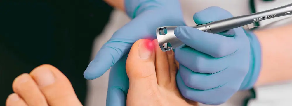 laser podologiczny Toruń, zabieg w gabinecie Zdrowe Stopy